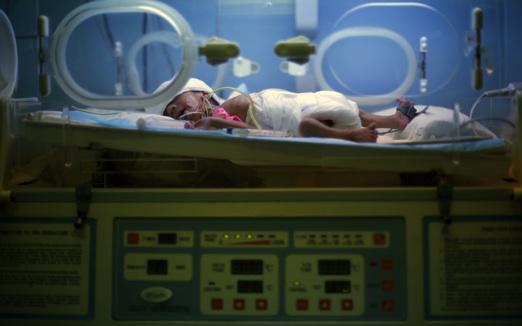 Enfant prématuré : «  Le cas le plus difficile de la médecine moderne »