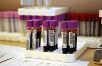 Un seul test sanguin pour dépister 13 types de cancer