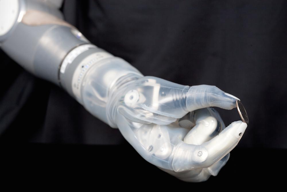La première prothèse de bras hi-tech commercialisée aux Etats-Unis