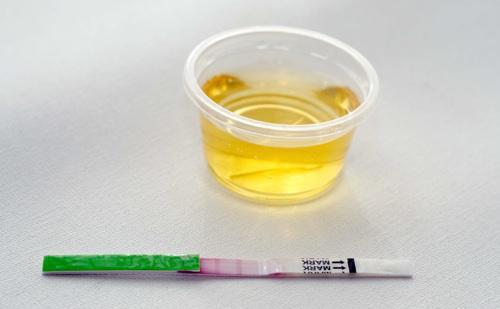 Papillomavirus : des tests urinaires efficaces pour le dépister 