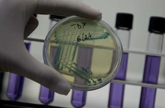 Antibiotiques : comment les bactéries transmettent leur résistance   