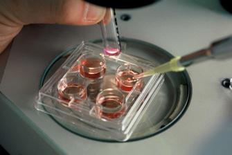 Congélation d’ovocytes : qui est concernée en France