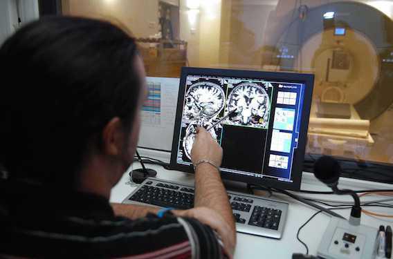 Alzheimer : des chercheurs français découvrent une nouvelle protéine impliquée dans la maladie