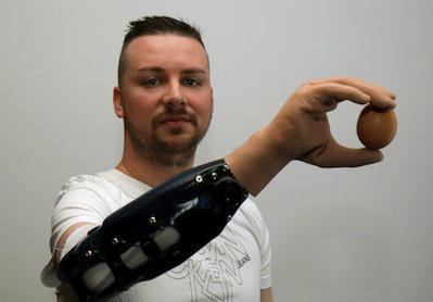 Une main bionique aussi efficace qu’une greffe