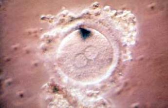 Infertilité : premiers essais de création d'ovules et de sperme artificiels 