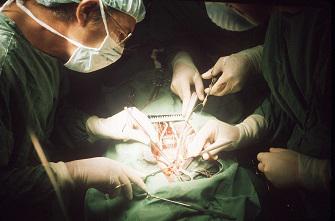 L’impression 3D au service de la chirurgie cardiaque   