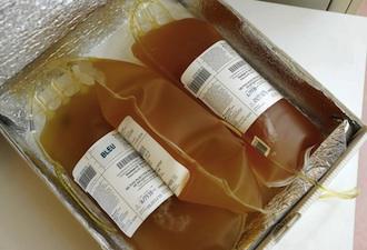 Ebola : la transfusion de sang ouvre une nouvelle piste