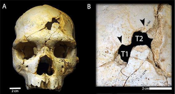 Un meurtre vieux de 430 000 ans découvert en Espagne