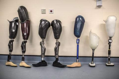 Une prothèse permet de retrouver la sensation de la marche