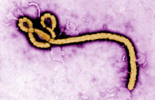 Le point faible d'Ebola identifié