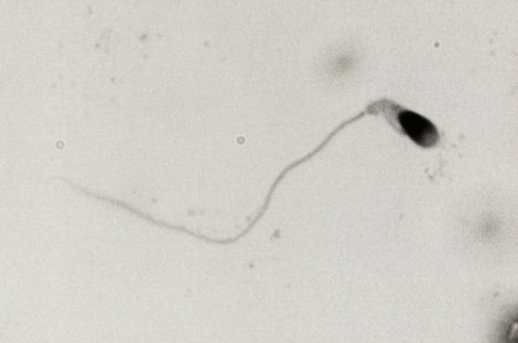 Assistance à la procréation : des Français auraient créé des spermatozoïdes in vitro