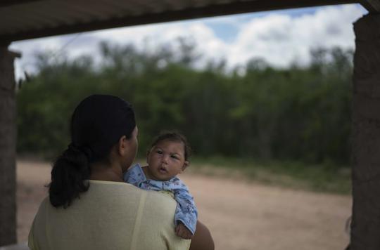 Zika : 641 cas de microcéphalie et 139 bébés décédés