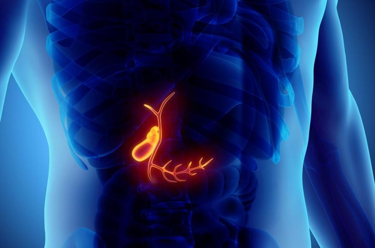 Calculs biliaires - DIAGNOSTIC - Pourquoi Docteur