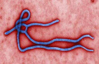 Ebola : risque de transmission par le sperme 82 jours après une guérison 