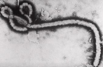 Ebola : des chercheurs découvrent pourquoi il est si mortel