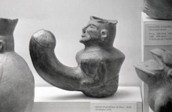 Réduction du pénis : une première mondiale réalisée aux Etats-Unis