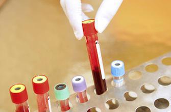 Un test sanguin pour prédire son risque de décès dans les 5 ans