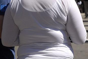 76 % des Français réduisent l'obésité à un problème d'alimentation