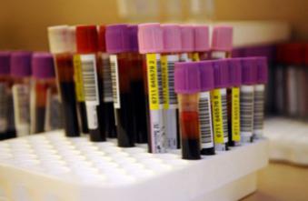 Cancer : une analyse de sang plutôt qu’une ponction