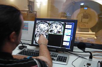 Alzheimer : son point de départ dans le cerveau localisé   