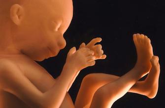 Un fœtus dans la vessie