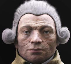 Robespierre : l'incorruptible souffrait de sarcoïdose et de la variole