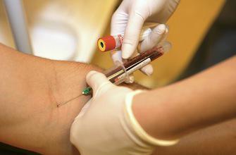 Cancer : la biopsie bientôt remplacée par une simple prise de sang
