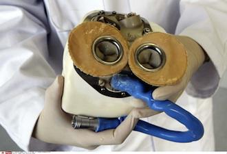 Coeur artificiel : un deuxième patient implanté dans le plus grand secret