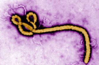 Ebola : l’hôpital Bichat est prêt à accueillir des malades
