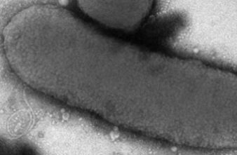 Nourrissons de Chambéry : la bactérie tueuse identifiée 