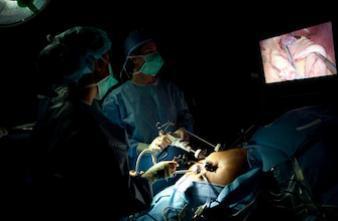 La chirurgie bariatrique réduit le risque de cancer de l'utérus