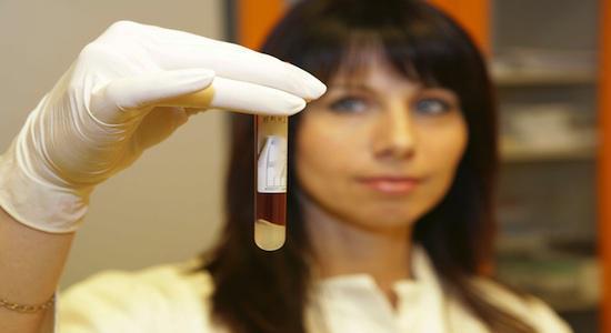 Trisomie 21 : les tests sanguins plus performants que l'amniocentèse 