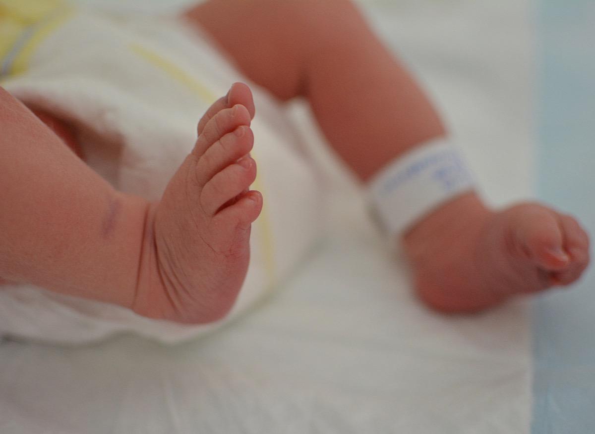 Un bébé naît avec quatre bras et quatre jambes