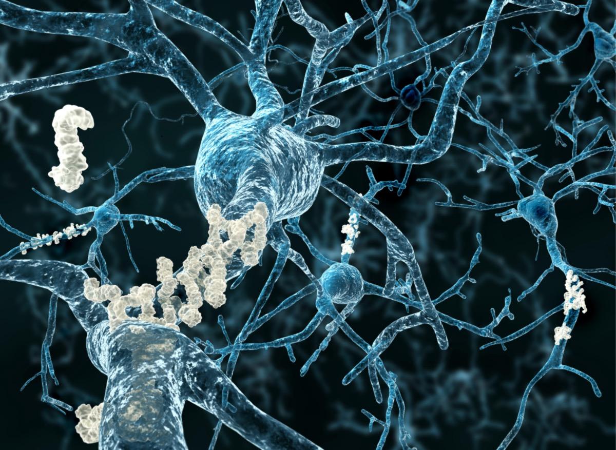 Alzheimer : la progression de la maladie filmée dans le cerveau de la souris