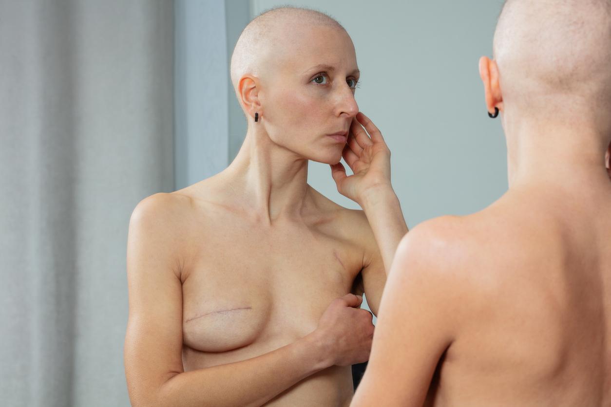 Cancer du sein : comment la mastectomie impacte la santé sexuelle et la qualité de vie