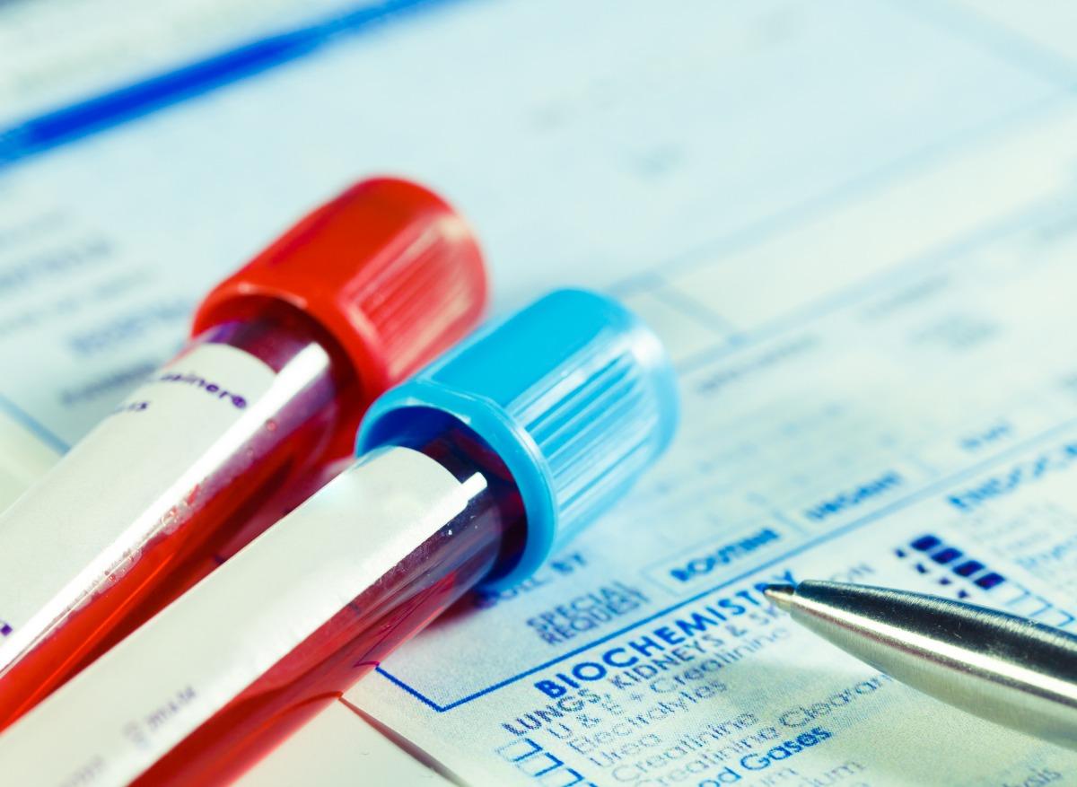 Fibromyalgie : l’espoir d’un test sanguin pour diagnostiquer la maladie