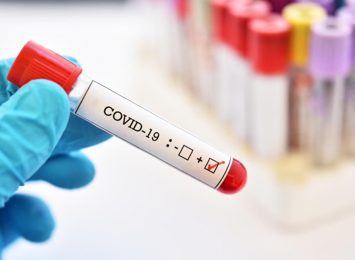Covid-19 : des entreprises se lancent dans la course au test sérologique