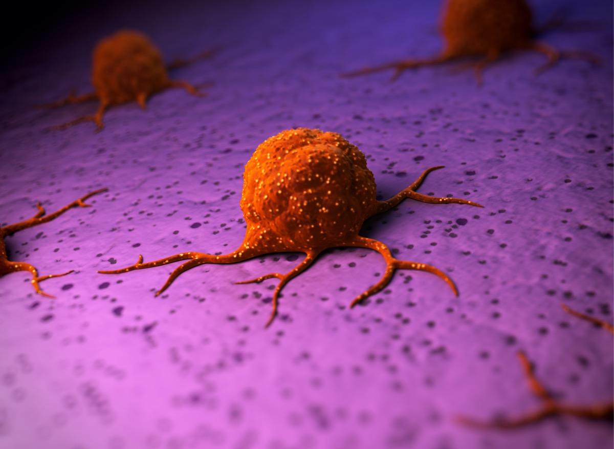Cancer : la membrane qui entoure les tumeurs, une clé pour éviter les métastases ?