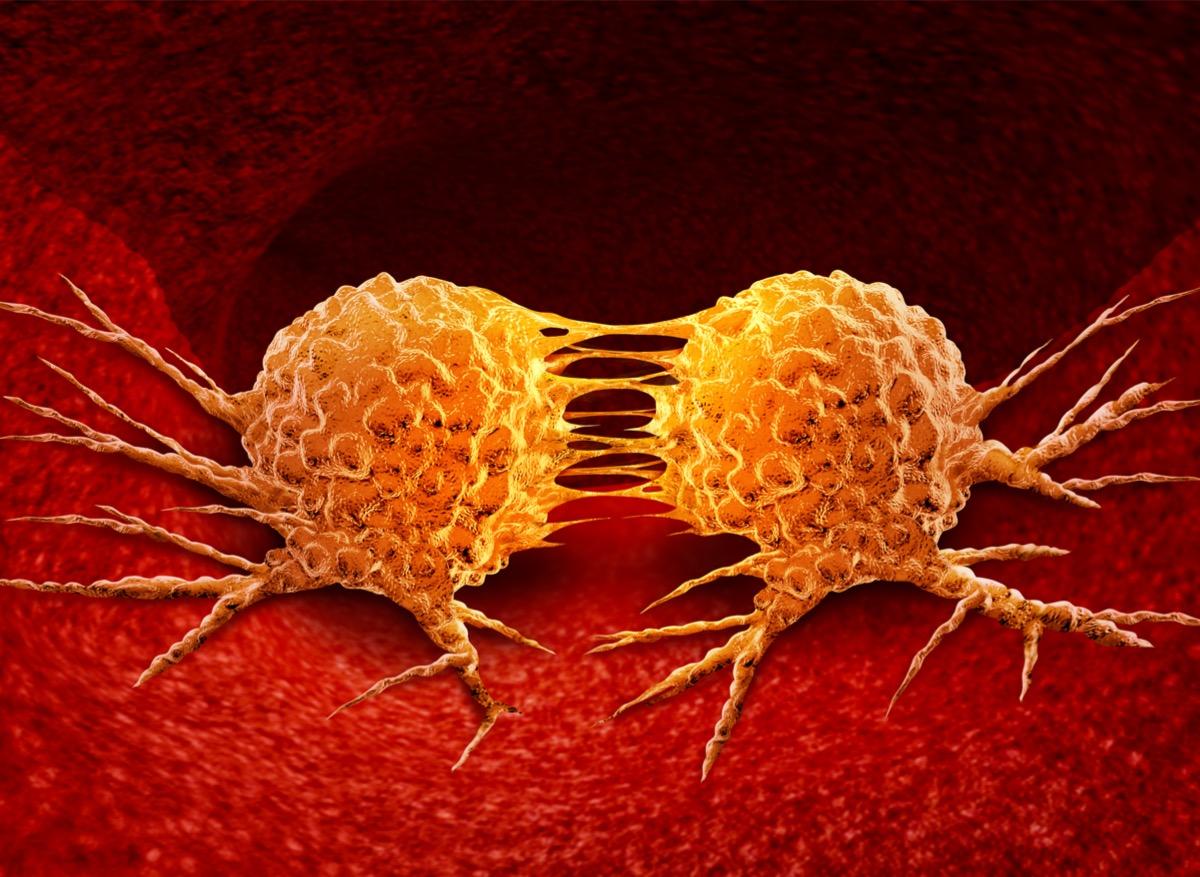 Métastases : comment les cellules cancéreuses deviennent agressives ?