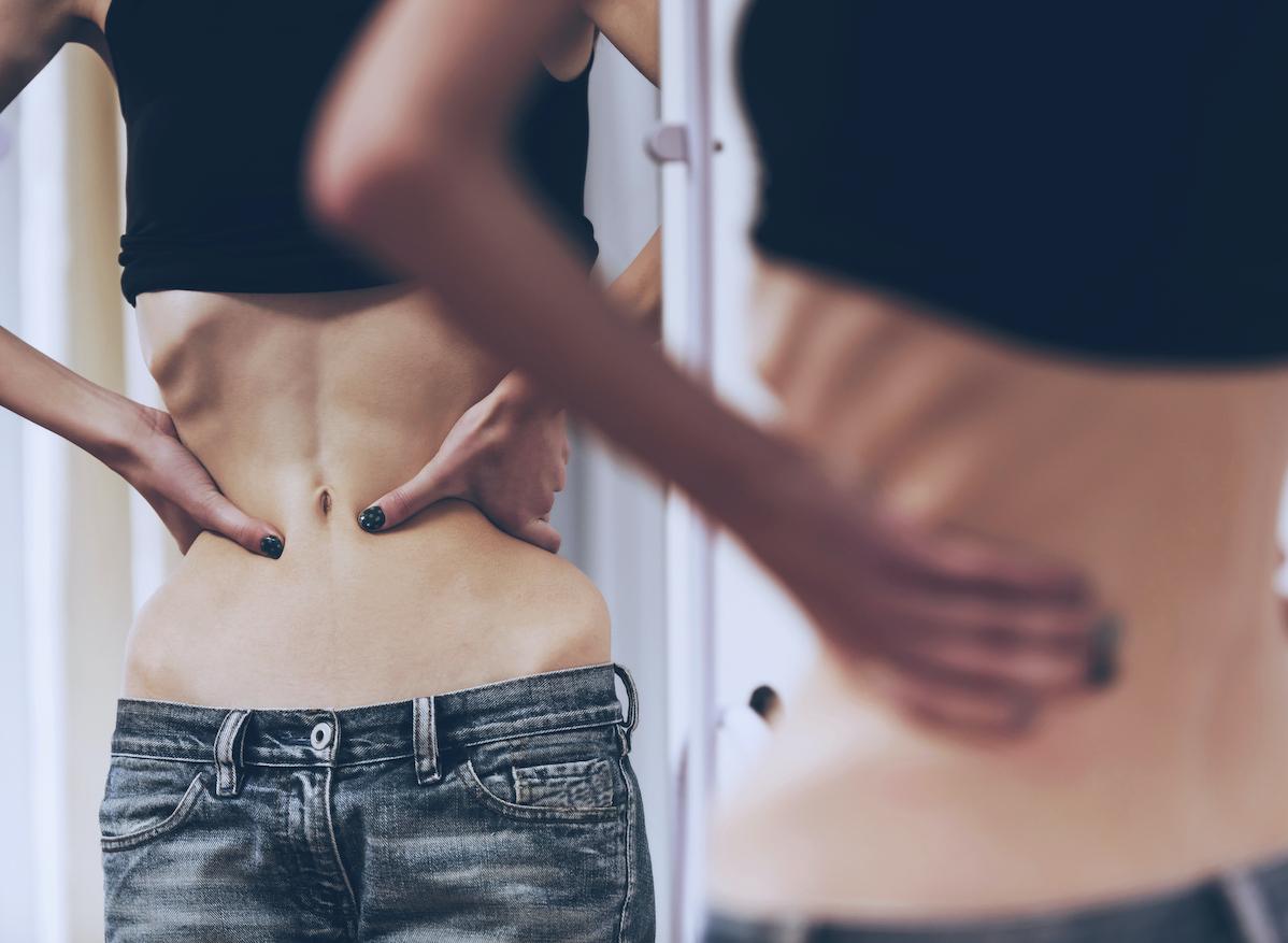L'anorexie peut ralentir la croissance des jeunes femmes