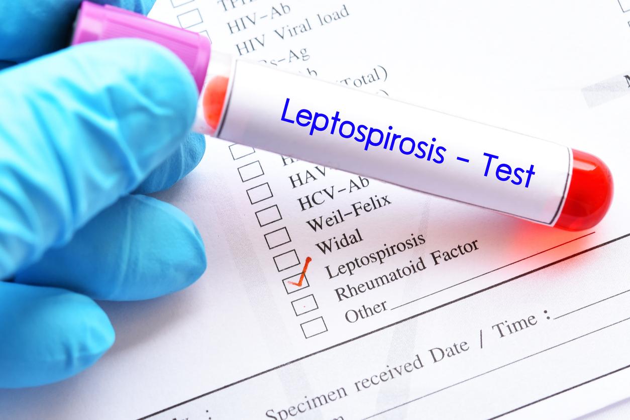 Épidémie de leptospirose à La Réunion : quels sont les risques ?