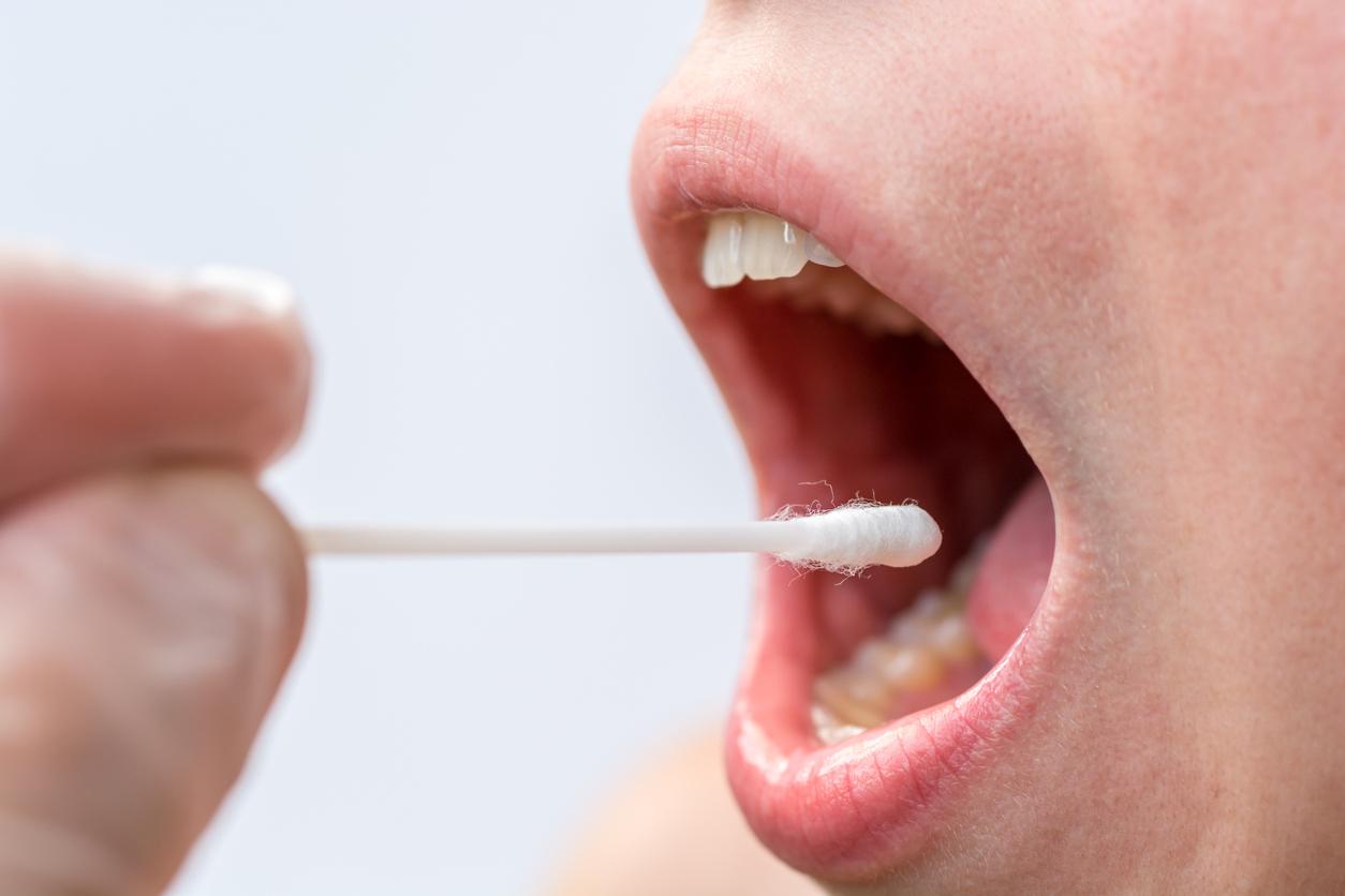 Cancer de la cavité buccale : un test salivaire pour faciliter le diagnostic 
