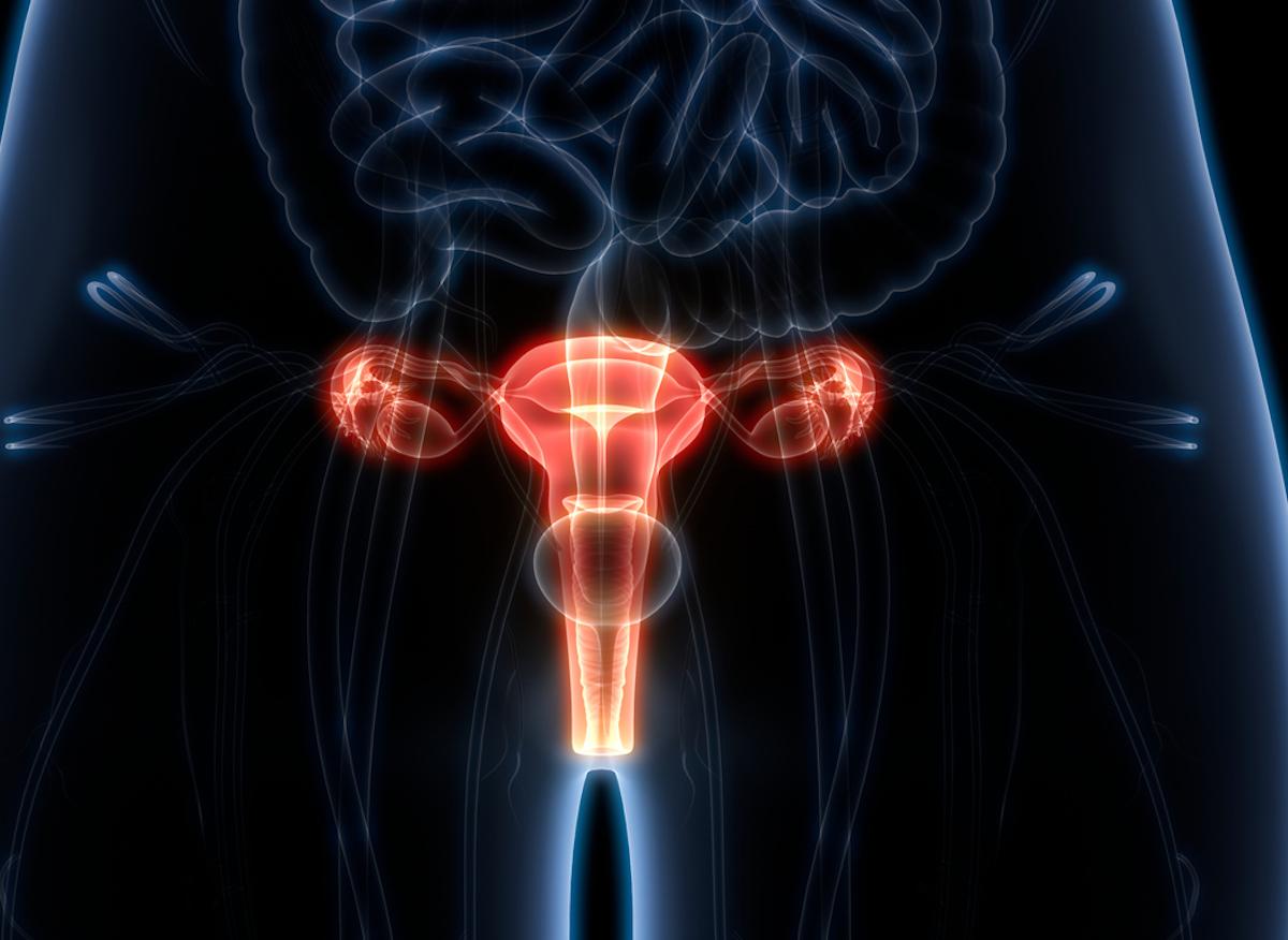 Cancer de l'ovaire : souvent silencieux, parfois héréditaire