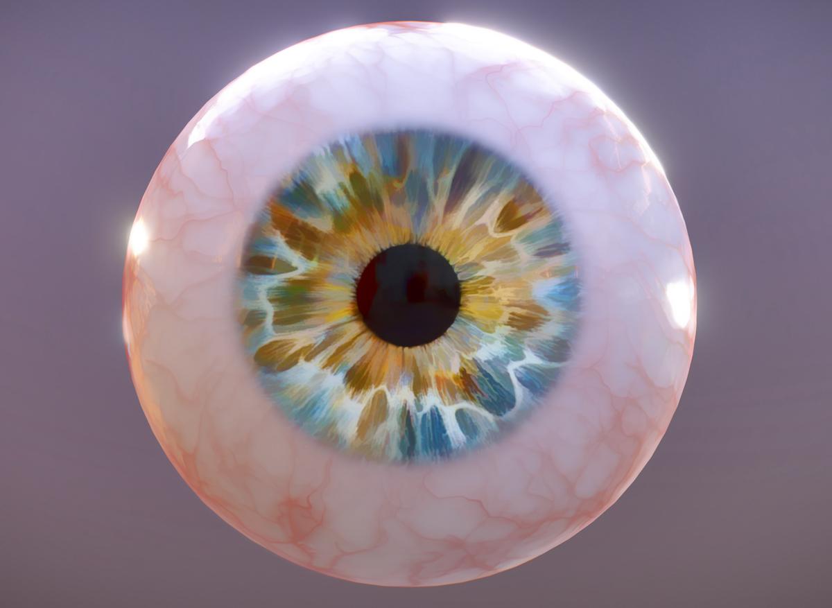 Un Londonien reçoit le premier faux œil greffé réalisé en 3D