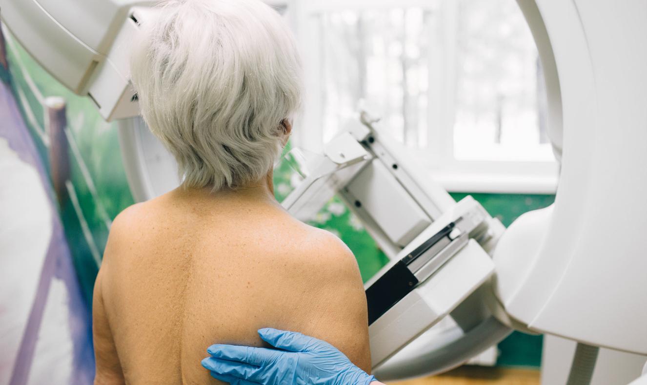 Cancer colorectal et du sein : un dépistage toujours insuffisant en France