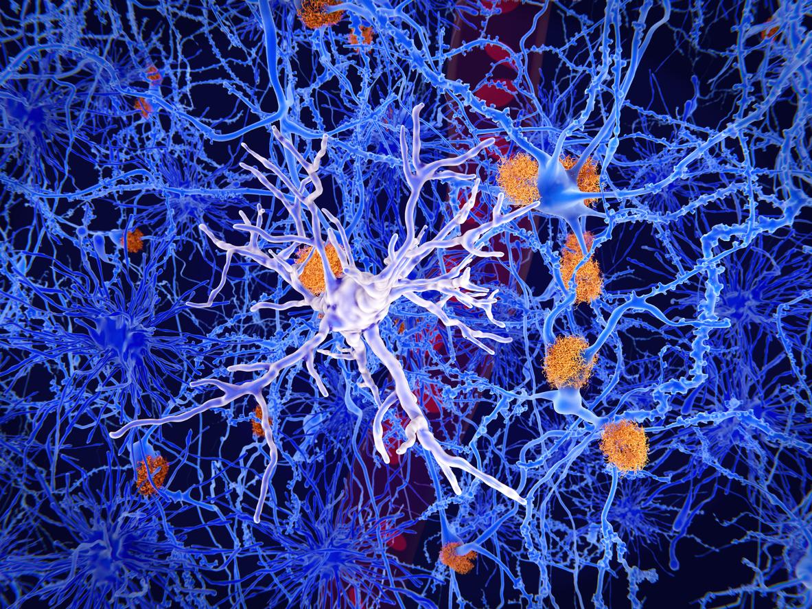 Alzheimer: pourquoi les neurones de la mémoire sont les plus vulnérables à la maladie?