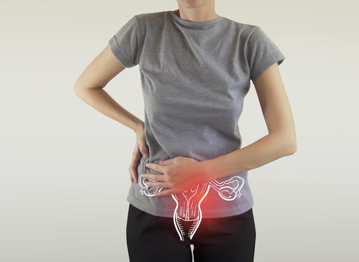 Dépistage du cancer du col de l'utérus : la campagne qui fait scandale en Grande Bretagne