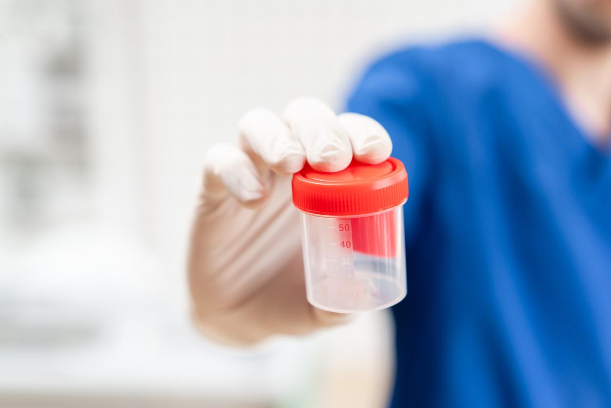 Alzheimer : un test urinaire pour détecter les formes précoces ? 
