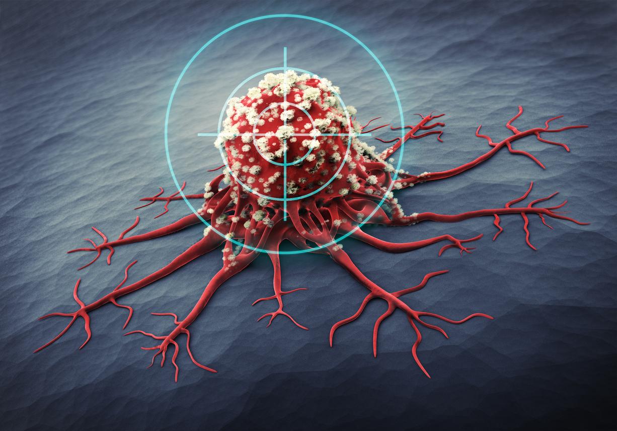 Métastases dans le cancer du sein : comment les cellules agressives se développent en se cachant 
