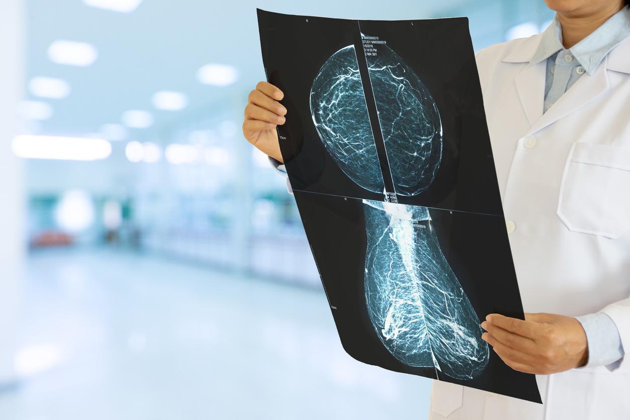 Breast cancer: a mechanism favoring metastases has been discovered 